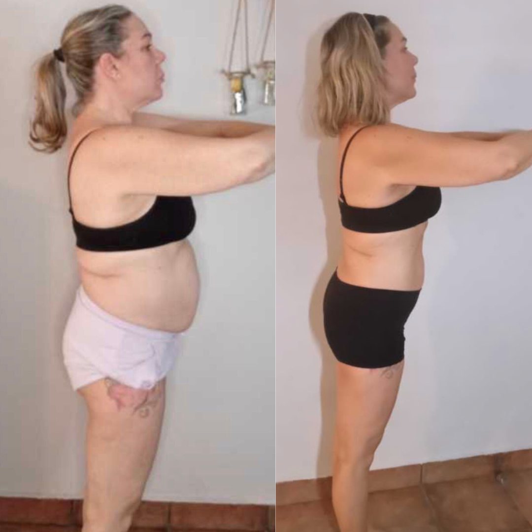 Antes y después de una clienta de MKGV