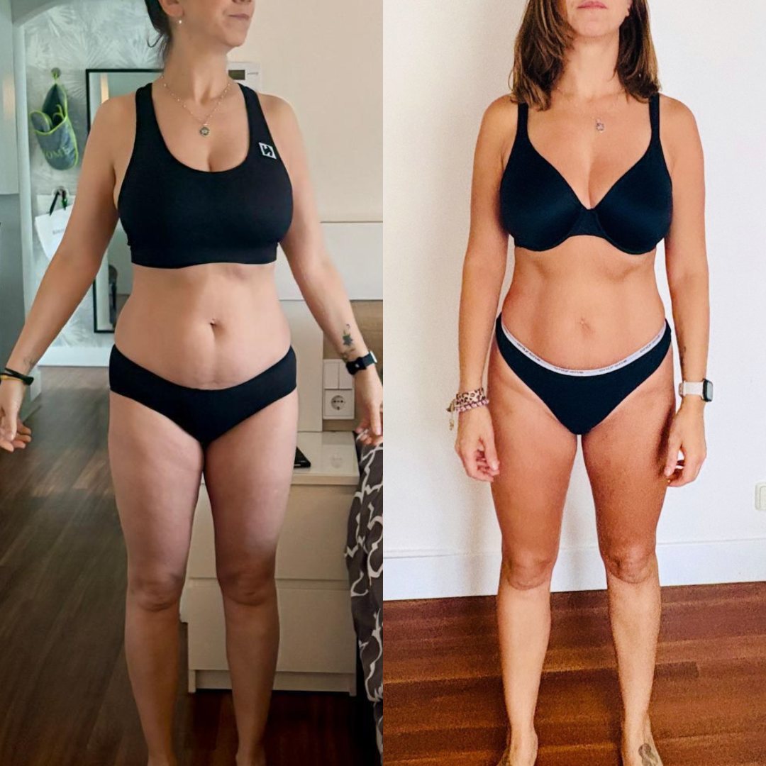 Antes y después de una clienta de MKGV